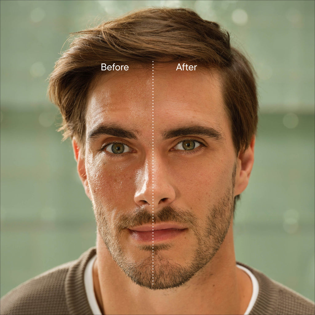 Before and after comparison of a man's face with a blurred background