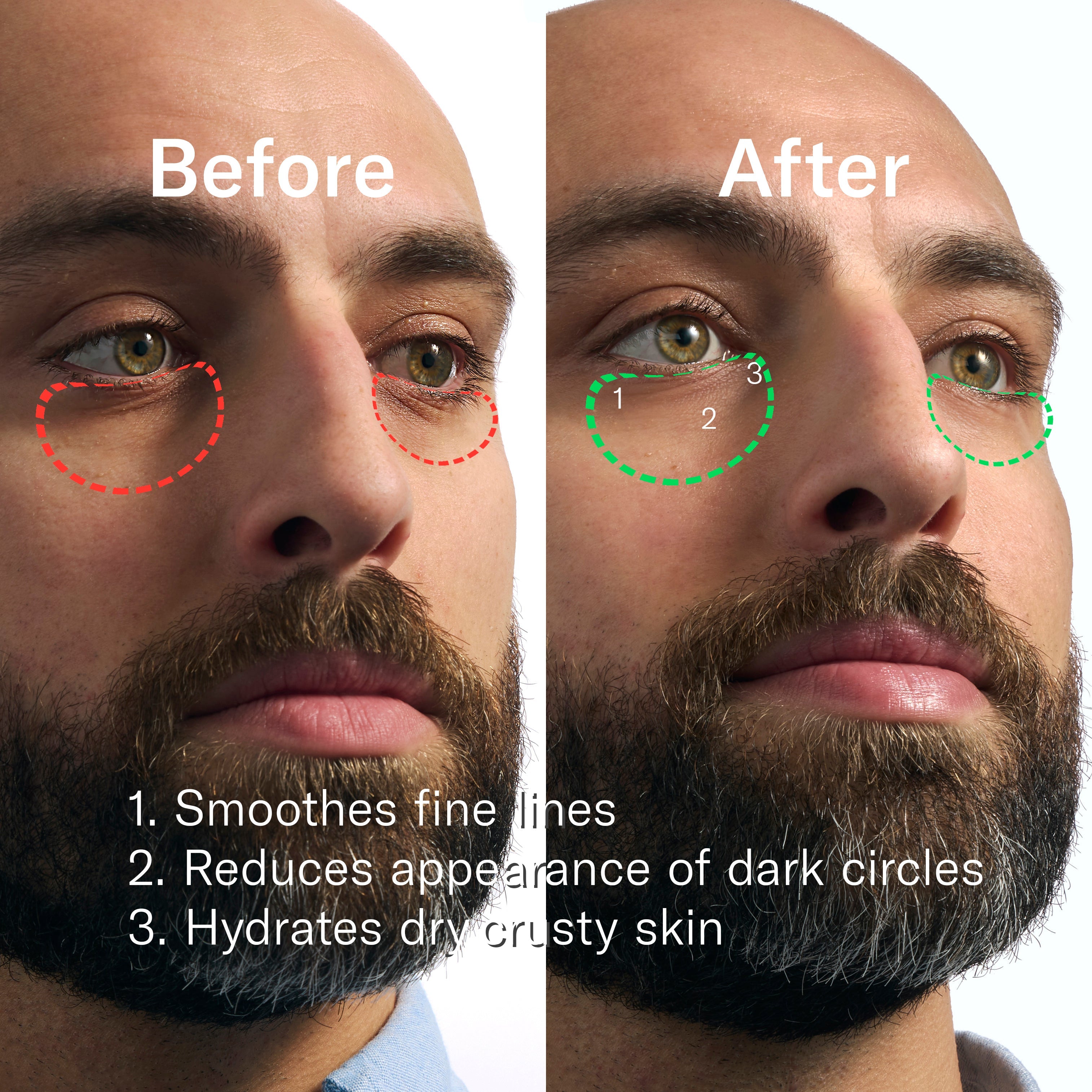 Rapid Restore Eye Patches - 6 pack - Smooth Fresh Shave